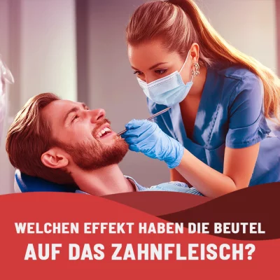Snus Zahnfleisch: Welchen Effekt?